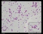 Peptostreptococcus anaerobius